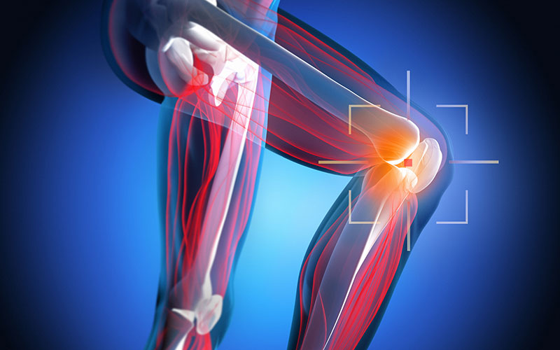 patellar